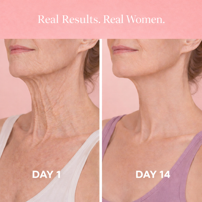 Neck & Jawline Sculptor